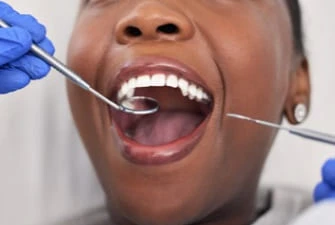 Cosmetic gum surgery at Summit Dental Care
