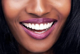 Teeth whitening at Summit Dental Care